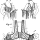 Illustration for article titled Behold Super Olde-Tymey Brassiere Devices